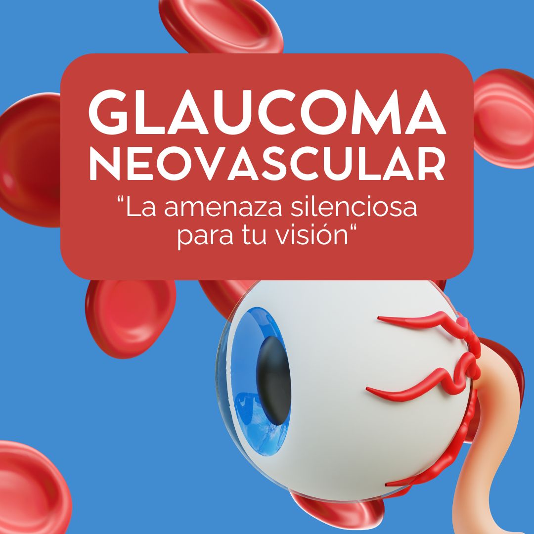 Cuidemos las ventanas del alma