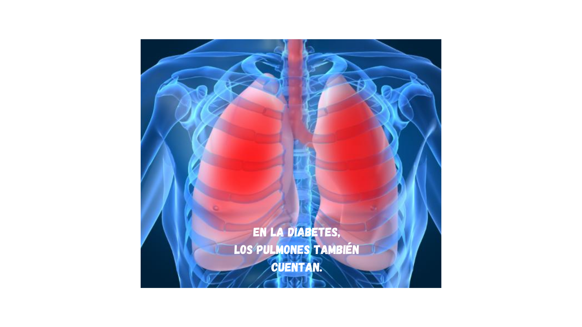 PREVENCIÓN EN LA DIABETES, MÁS ALLÁ DE LOS ÓRGANOS DIANA.